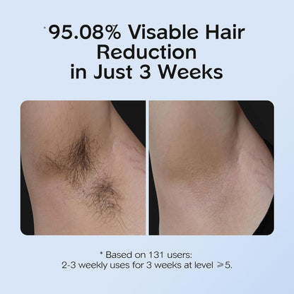 IPL Hair Removal Device for Armpits, Legs, Arms, Bikini Line & Corded